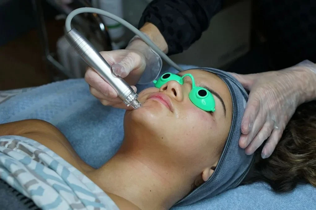 Hydrafacial treatment compared to chemical peel